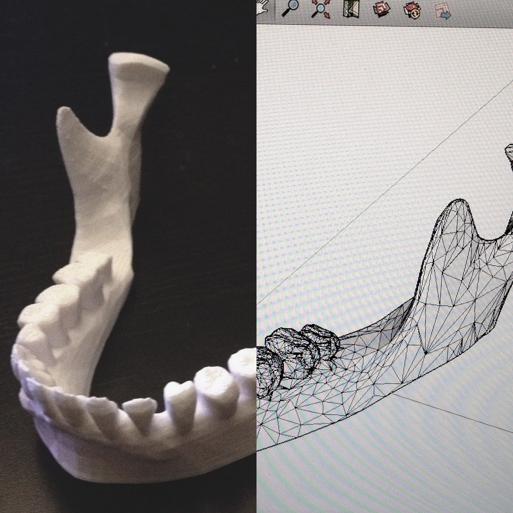 Jaw iPad-stativ: Human Jaw Model och iPad-hållare